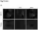 Fig. 07 - AAV GENE THERAPY FOR TREATING NEPHROTIC SYNDROME