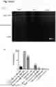 Fig. 11 - AAV GENE THERAPY FOR TREATING NEPHROTIC SYNDROME