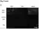 Fig. 12 - AAV GENE THERAPY FOR TREATING NEPHROTIC SYNDROME