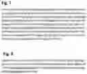 Fig. 19 - AAV GENE THERAPY FOR TREATING NEPHROTIC SYNDROME