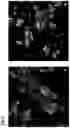 Fig. 20 - AAV GENE THERAPY FOR TREATING NEPHROTIC SYNDROME