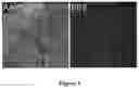 Fig. 02 - DELIVERY OF POLYNUCLEOTIDES USING RECOMBINANT AAV9