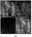 Fig. 05 - DELIVERY OF POLYNUCLEOTIDES USING RECOMBINANT AAV9