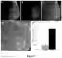 Fig. 08 - DELIVERY OF POLYNUCLEOTIDES USING RECOMBINANT AAV9