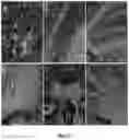 Fig. 12 - DELIVERY OF POLYNUCLEOTIDES USING RECOMBINANT AAV9
