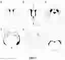 Fig. 14 - DELIVERY OF POLYNUCLEOTIDES USING RECOMBINANT AAV9