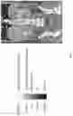 Fig. 02 - PER-ORAL NEGATIVE CONTRAST AGENT FOR ABDOMINAL IMAGING