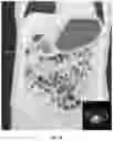 Fig. 04 - PER-ORAL NEGATIVE CONTRAST AGENT FOR ABDOMINAL IMAGING