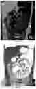 Fig. 06 - PER-ORAL NEGATIVE CONTRAST AGENT FOR ABDOMINAL IMAGING