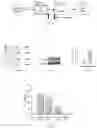 Fig. 03 - Compositions and methods to detect GLUA1 in brain and to identify the presence of GLUA1-mediated PTSD