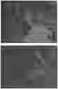 Fig. 01 - WOUND CLOSURE DEVICES COMPRISING PROTOCATECHUIC ACID