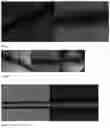 Fig. 04 - WOUND CLOSURE DEVICES COMPRISING PROTOCATECHUIC ACID