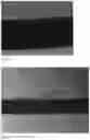 Fig. 06 - WOUND CLOSURE DEVICES COMPRISING PROTOCATECHUIC ACID