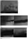 Fig. 07 - WOUND CLOSURE DEVICES COMPRISING PROTOCATECHUIC ACID