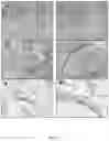 Fig. 04 - Bone implant composition