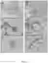 Fig. 05 - Bone implant composition