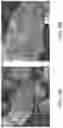 Fig. 09 - Eggshell Particle Containing Hydrogels And Prepolymer Compositions For Biomedical Applications