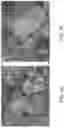 Fig. 11 - Eggshell Particle Containing Hydrogels And Prepolymer Compositions For Biomedical Applications