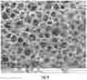 Fig. 10 - MESH-BASED IN SITU CROSS-LINKABLE COMPOSITIONS