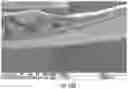 Fig. 16 - MESH-BASED IN SITU CROSS-LINKABLE COMPOSITIONS