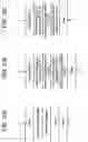 Fig. 11 - System for removing uremic toxins in dialysis processes