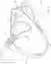 Fig. 04 - THERMOFORMED MASK