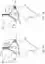 Fig. 31 - Strap assembly, strap connector, headgear, headgear assembly, method of forming headgear, tubular connector, patient interface and method of joining straps