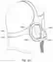 Fig. 90 - Strap assembly, strap connector, headgear, headgear assembly, method of forming headgear, tubular connector, patient interface and method of joining straps