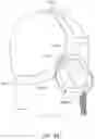 Fig. 93 - Strap assembly, strap connector, headgear, headgear assembly, method of forming headgear, tubular connector, patient interface and method of joining straps