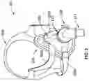 Fig. 03 - System and methods for triggering sounds to mask noise from respiratory systems and their components
