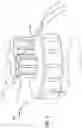 Fig. 08 - Catheter placement system with stiffening system