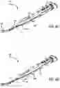 Fig. 10 - Catheter placement system with stiffening system