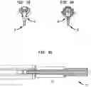 Fig. 23 - Insertion device for one-handed insertion of a guidewire into the lumen of a vessel/cavity