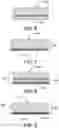 Fig. 05 - Implantable encapsulation devices