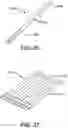 Fig. 31 - Implantable encapsulation devices