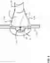 Fig. 05 - VASCULAR ACCESS