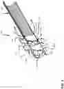 Fig. 10 - VASCULAR ACCESS