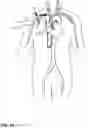 Fig. 22 - VASCULAR ACCESS