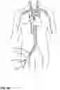 Fig. 23 - VASCULAR ACCESS