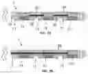 Fig. 07 - Cochlear implant device with a flexible electrode array
