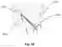 Fig. 23 - Method for implanting a stimulator with a foil-like electrode portion