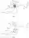 Fig. 02 - Method and apparatus for transdermal stimulation over the palmar and plantar surfaces
