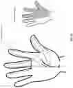 Fig. 49 - Method and apparatus for transdermal stimulation over the palmar and plantar surfaces