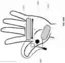 Fig. 63 - Method and apparatus for transdermal stimulation over the palmar and plantar surfaces