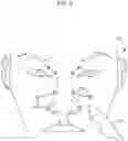 Fig. 05 - METHOD FOR USING A SINUS TREATMENT DEVICE