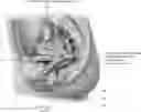 Fig. 01 - Intravaginal electrical stimulation device for treating female pelvic pain