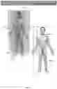 Fig. 02 - Intravaginal electrical stimulation device for treating female pelvic pain