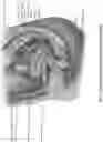 Fig. 03 - Intravaginal electrical stimulation device for treating female pelvic pain