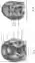 Fig. 04 - Intravaginal electrical stimulation device for treating female pelvic pain