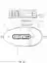 Fig. 25 - Intravaginal electrical stimulation device for treating female pelvic pain